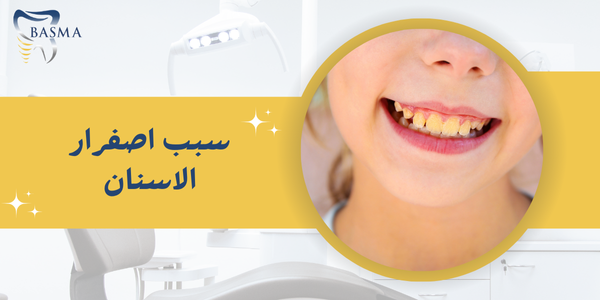 سبب اصفرار الاسنان